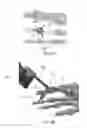 Fig. 12 - DEVICES FOR BONE FIXATION USING AN INTRAMEDULLARY FIXATION IMPLANT