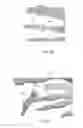 Fig. 13 - DEVICES FOR BONE FIXATION USING AN INTRAMEDULLARY FIXATION IMPLANT