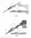 Fig. 16 - DEVICES FOR BONE FIXATION USING AN INTRAMEDULLARY FIXATION IMPLANT
