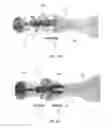 Fig. 19 - DEVICES FOR BONE FIXATION USING AN INTRAMEDULLARY FIXATION IMPLANT