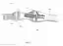 Fig. 04 - Methods for bone fixation using an intramedullary fixation implant