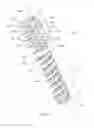 Fig. 05 - Methods for bone fixation using an intramedullary fixation implant