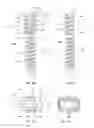 Fig. 06 - Methods for bone fixation using an intramedullary fixation implant