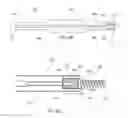 Fig. 10 - Methods for bone fixation using an intramedullary fixation implant