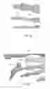 Fig. 13 - Methods for bone fixation using an intramedullary fixation implant