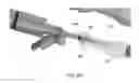 Fig. 15 - Methods for bone fixation using an intramedullary fixation implant