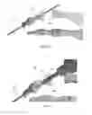 Fig. 16 - Methods for bone fixation using an intramedullary fixation implant