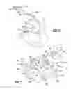 Fig. 04 - Ligament Guide Registration