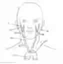 Fig. 01 - Electrical stimulation of the carotid artery