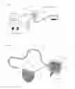 Fig. 07 - Electrical stimulation of the carotid artery