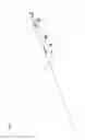 Fig. 02 - Delivery catheter systems and methods
