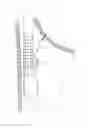 Fig. 25 - Methods and devices for manipulating and fastening tissue
