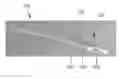 Fig. 01 - Method and apparatus for trabeculectomy and suprachoroidal shunt surgery