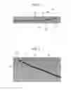 Fig. 03 - Method and apparatus for trabeculectomy and suprachoroidal shunt surgery