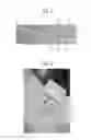 Fig. 04 - Method and apparatus for trabeculectomy and suprachoroidal shunt surgery