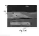 Fig. 28 - Methods and devices for selective disruption of fatty tissue by controlled cooling