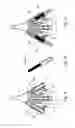 Fig. 03 - SYSTEM AND METHOD FOR TREATING URINARY TRACT DISORDERS