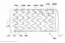 Fig. 01 - Segmented Balloon Expandable Stent Graft With Reduced Foreshortening
