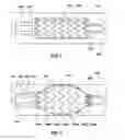 Fig. 06 - Segmented Balloon Expandable Stent Graft With Reduced Foreshortening