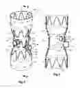 Fig. 02 - Fenestrated stent grafts