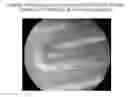 Fig. 01 - Coatings containing multiple drugs