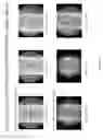 Fig. 07 - Coatings containing multiple drugs