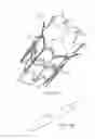 Fig. 16 - Systems, devices and methods for transcatheter valve delivery