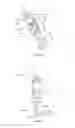 Fig. 06 - Prosthesis for a lower limb