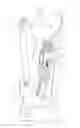Fig. 09 - Prosthesis for a lower limb