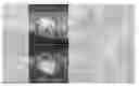 Fig. 01 - METHOD AND DEVICE FOR PROVIDING AN IMAGE PREVIEW