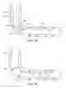 Fig. 05 - Drillable Debris Barrier Tool