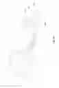 Fig. 10 - UNDERGROUND DRILLING APPARATUS