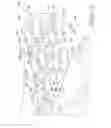 Fig. 03 - Jaw assembly for a demolition tool