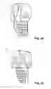 Fig. 09 - Railing and baluster plug system