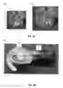 Fig. 06 - WEARABLE CHARGING DEVICE CONTROLLER AND METHODS