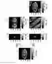 Fig. 06 - SYSTEMS AND METHODS FOR ACCELERATING MAGNETIC RESONANCE IMAGING