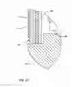 Fig. 28 - HEADER EMBEDDED FILTER FOR IMPLANTABLE MEDICAL DEVICE