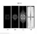 Fig. 10 - Liquid crystal display