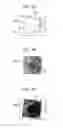 Fig. 02 - Ophthalmological apparatus, comparison method, and non-transitory storage medium