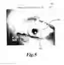Fig. 06 - Apparatus and method for determining physiologic perturbations of a patient