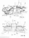 Fig. 02 - Low profile loudspeaker transducer