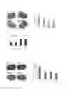 Fig. 07 - Method for producing natural killer cells, natural killer cells produced thereby, and composition for treating cancers and infectious diseases containing the same