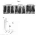 Fig. 02 - Methods of treating and preventing graft versus host disease