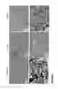 Fig. 02 - ENDOTHELIAL CELLS ACTIVATION BIOMARKERS CHARACTERIZING ANTIBODY MEDIATED REJECTION AND USES THEREOF
