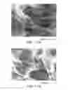 Fig. 28 - Compositions and Methods For Modulation of Vascular Structure and/or Function