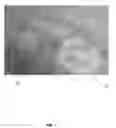 Fig. 02 - Anti-Fungal Compositions and Associated Methods