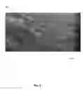 Fig. 03 - Anti-Fungal Compositions and Associated Methods