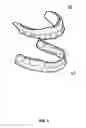 Fig. 02 - Device for removable attachment of dental prosthesis