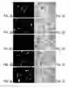 Fig. 04 - Methods for producing interfering RNA molecules in mammalian cells and therapeutic uses for such molecules