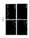 Fig. 08 - Method for screening ameliorants of dry skin caused by atopic dermatitis using bleomycin hydrolase activity as indicator